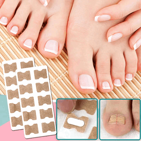 FinePatches™ | Patches correcteurs pour des ongles beaux et sains
