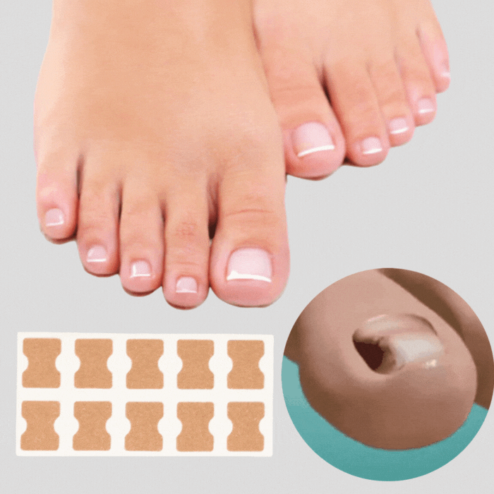 FinePatches™ | Patches correcteurs pour des ongles beaux et sains