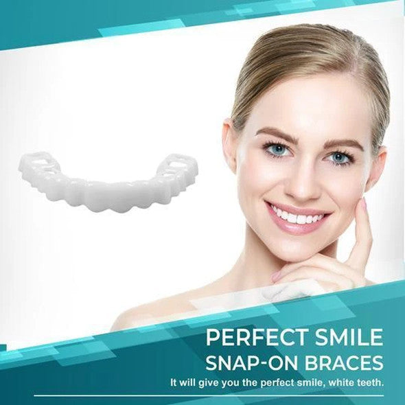 SMILELUX – Ensemble de Facettes Supérieures et Inférieures pour Améliorer l'Esthétique du Sourire