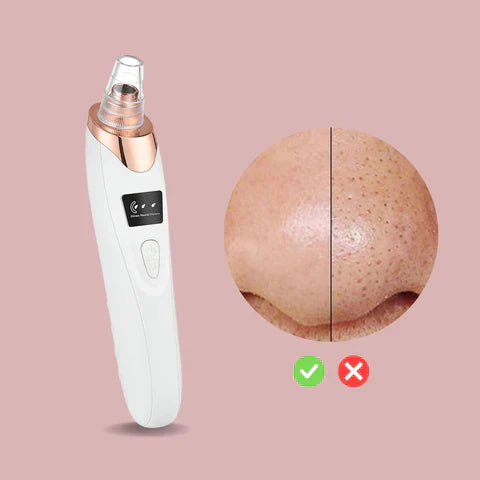 50% de réduction | PoreGlow™ | Éliminateur de points noirs