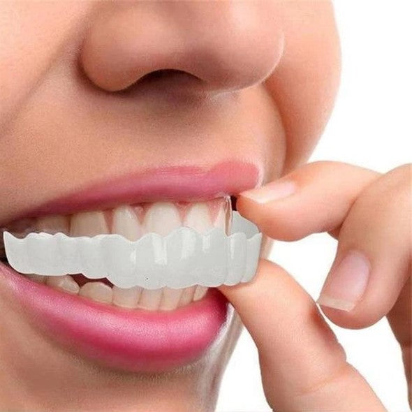 SMILELUX – Ensemble de Facettes Supérieures et Inférieures pour Améliorer l'Esthétique du Sourire