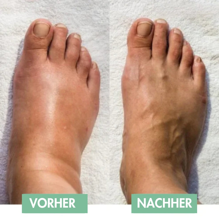 Revivax™ | Le massage des pieds EMS innovant pour un soulagement immédiat !