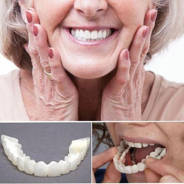 SMILELUX – Ensemble de Facettes Supérieures et Inférieures pour Améliorer l'Esthétique du Sourire