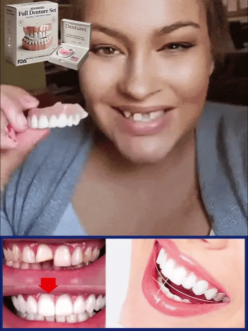 Prothèse Dentaire™ – Sourire Naturel, Ajustement Confortable & Réutilisable [50 % de réduction]