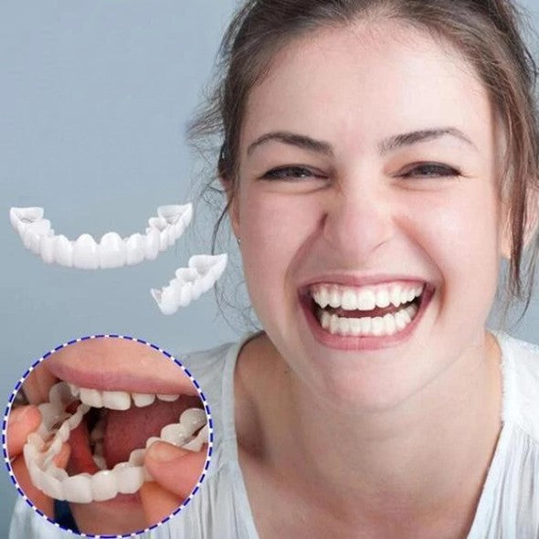 SMILELUX – Ensemble de Facettes Supérieures et Inférieures pour Améliorer l'Esthétique du Sourire