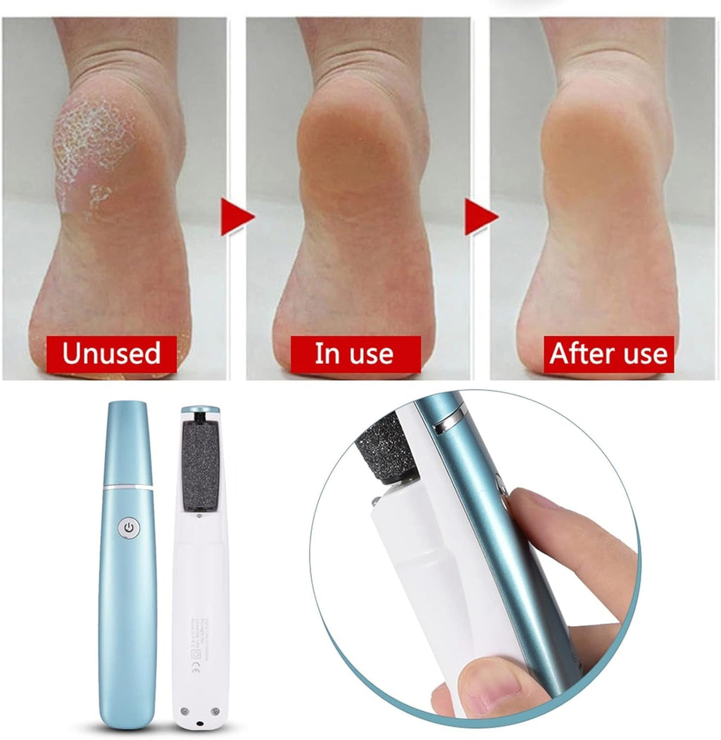 Pedilume™ | Machine électrique à poncer les pieds, éliminateur de callosités