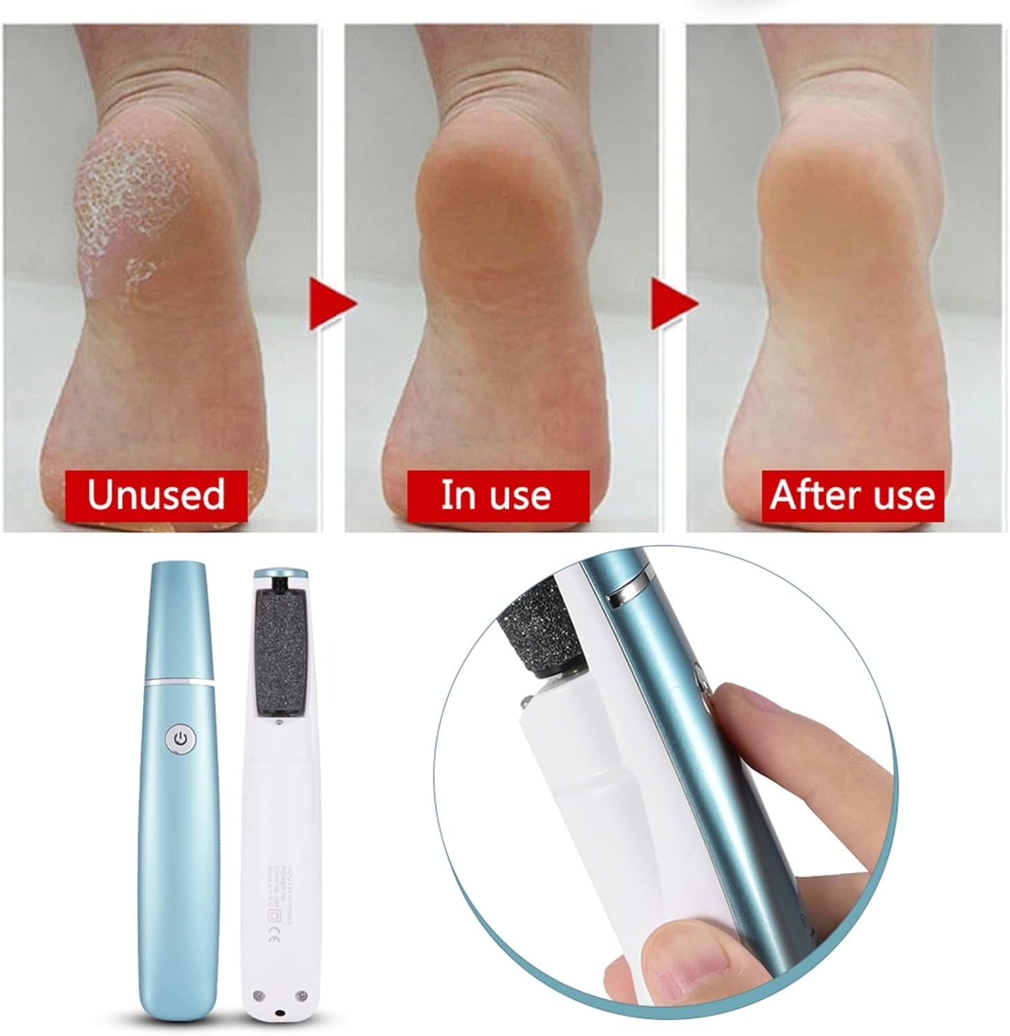 Pedilume™ | Machine électrique à poncer les pieds, éliminateur de callosités