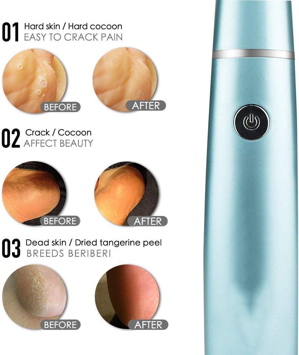 SilkaFeet™ | Des pieds lisses et soignés sans effort