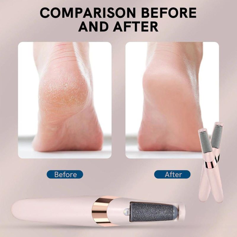 Fichier électrique pour pieds, éliminateur de callosités Skanto