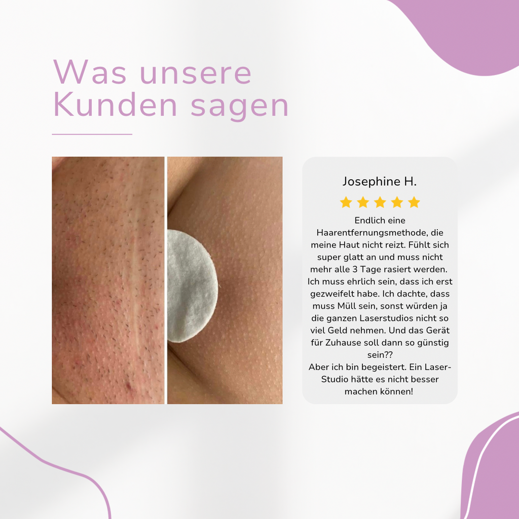 Venzani Ylvis IPL Épilateur I La meilleure épilation laser à domicile