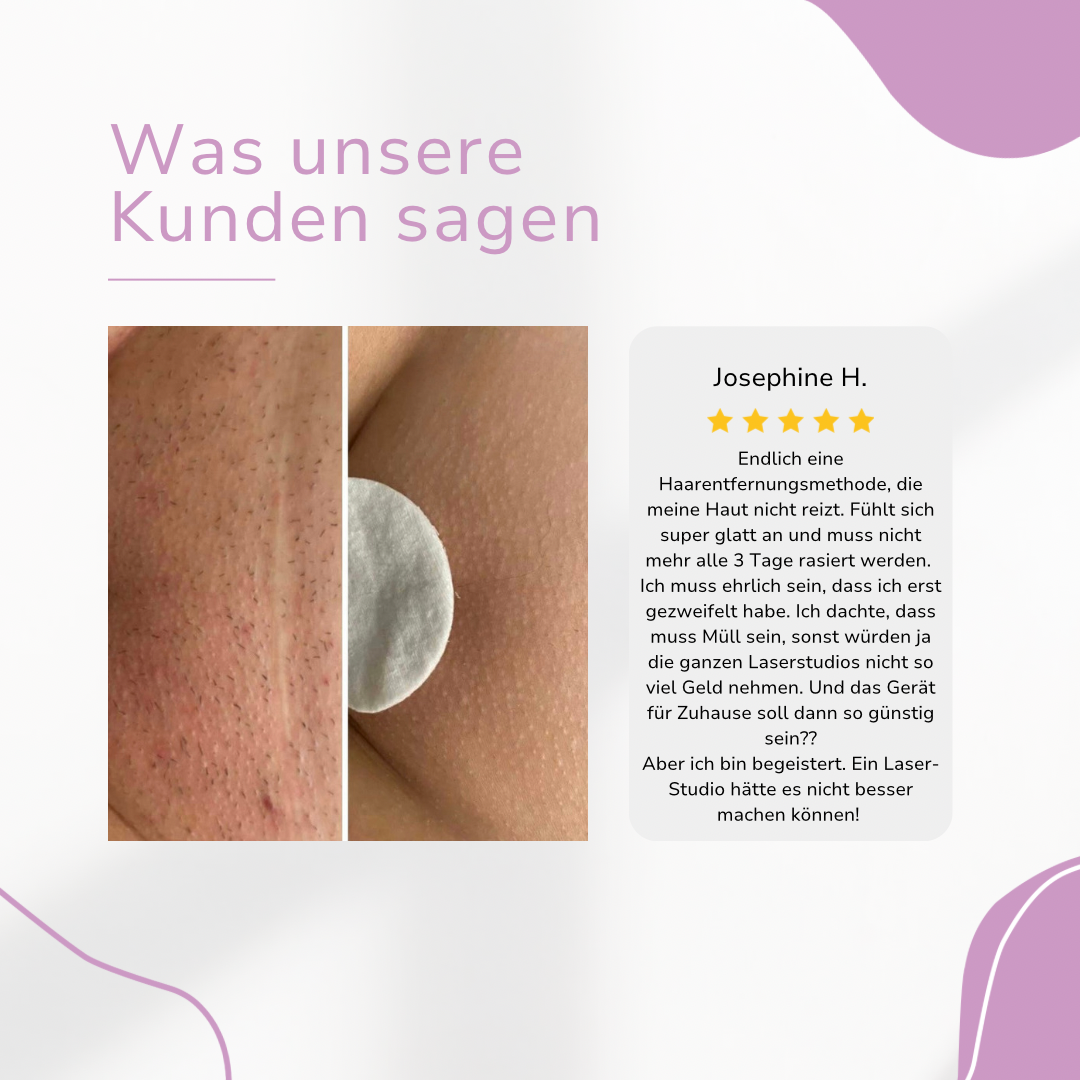 Venzani Ylvis IPL Épilateur I La meilleure épilation laser à domicile