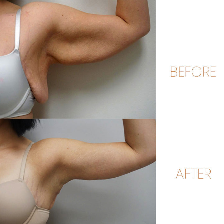 Anneau d'Acupression | Stimulation de Massage des Mains | Anneau de Confort Réglable | MagneticTherapy