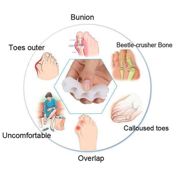 TOEALIGN – Alignement des orteils et soulagement de la douleur