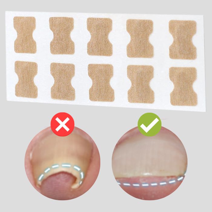 FinePatches™ | Patches correcteurs pour des ongles beaux et sains