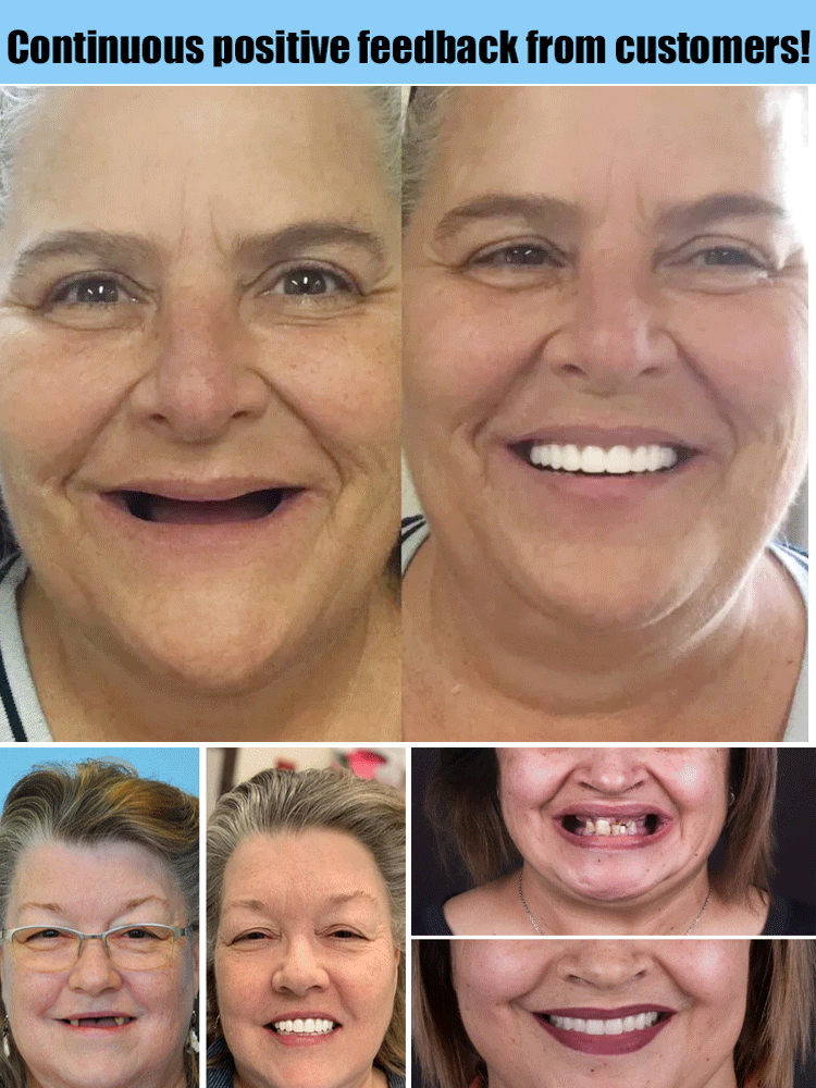 Prothèse Dentaire™ – Sourire Naturel, Ajustement Confortable & Réutilisable [50 % de réduction]