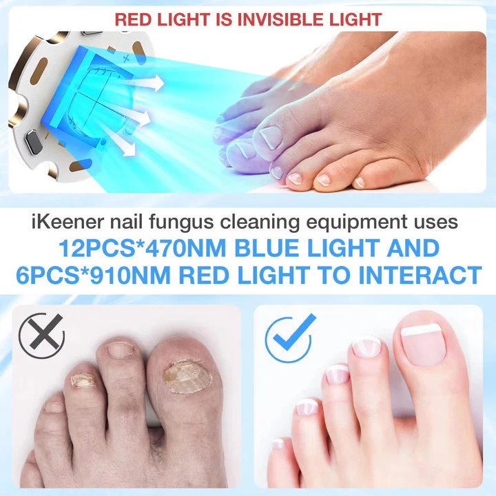 Laser pour ongles