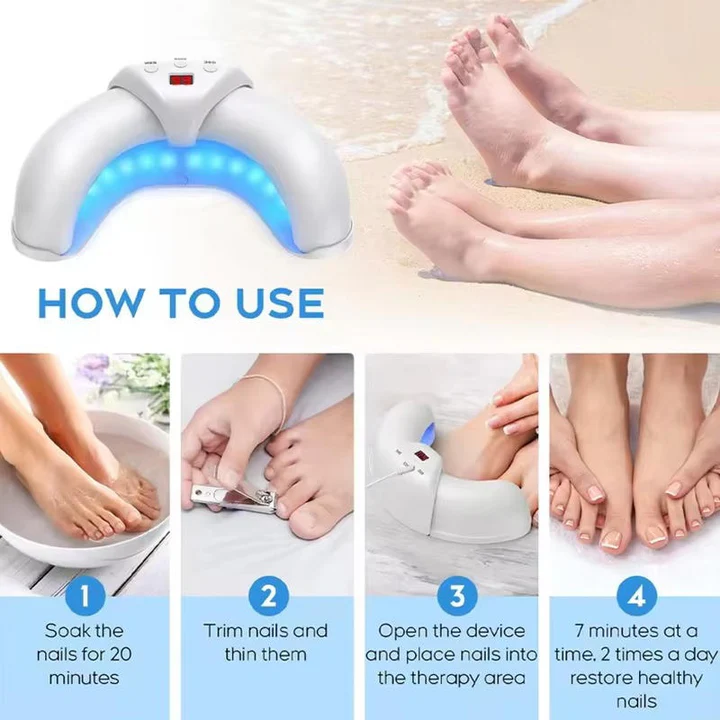 Laser pour ongles