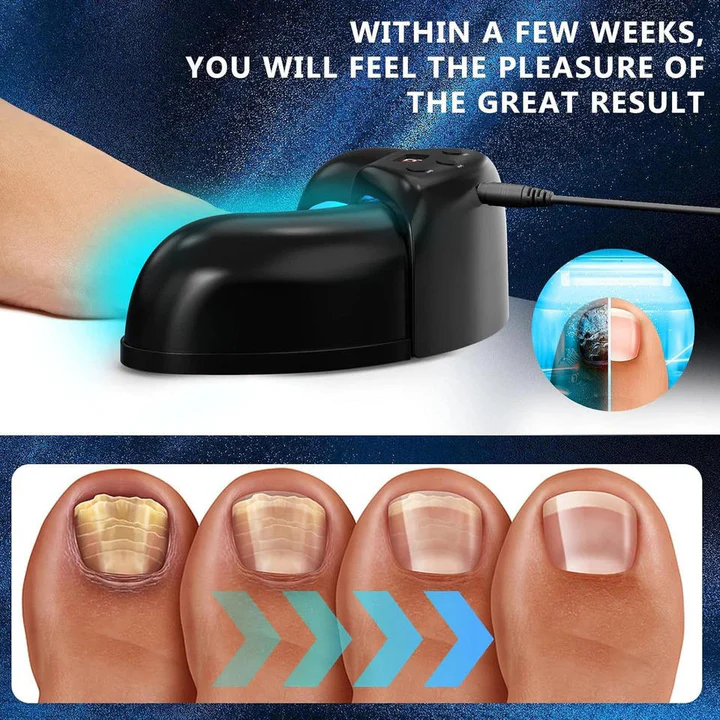 Laser pour ongles