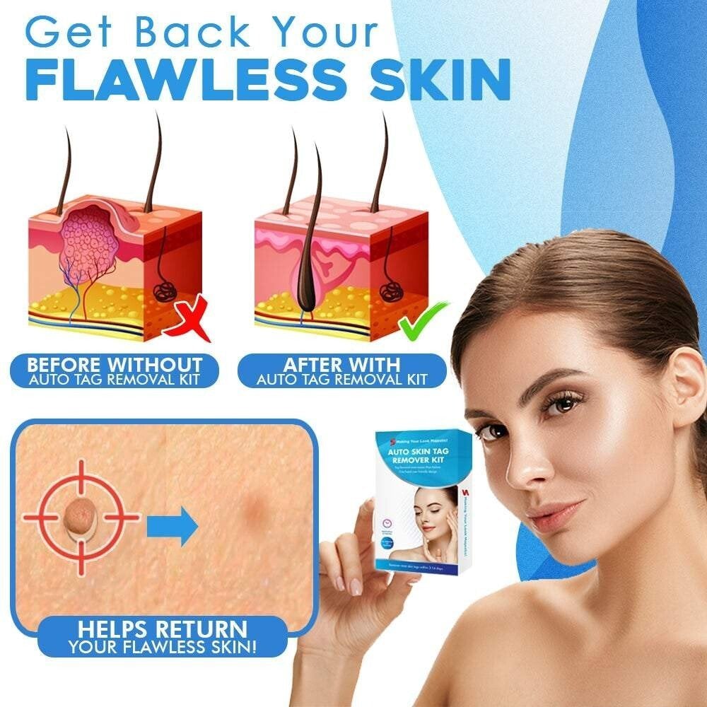 TagGone Kit de Retrait Auto-Tag | Application sans douleur | Pour une peau lisse et uniforme
