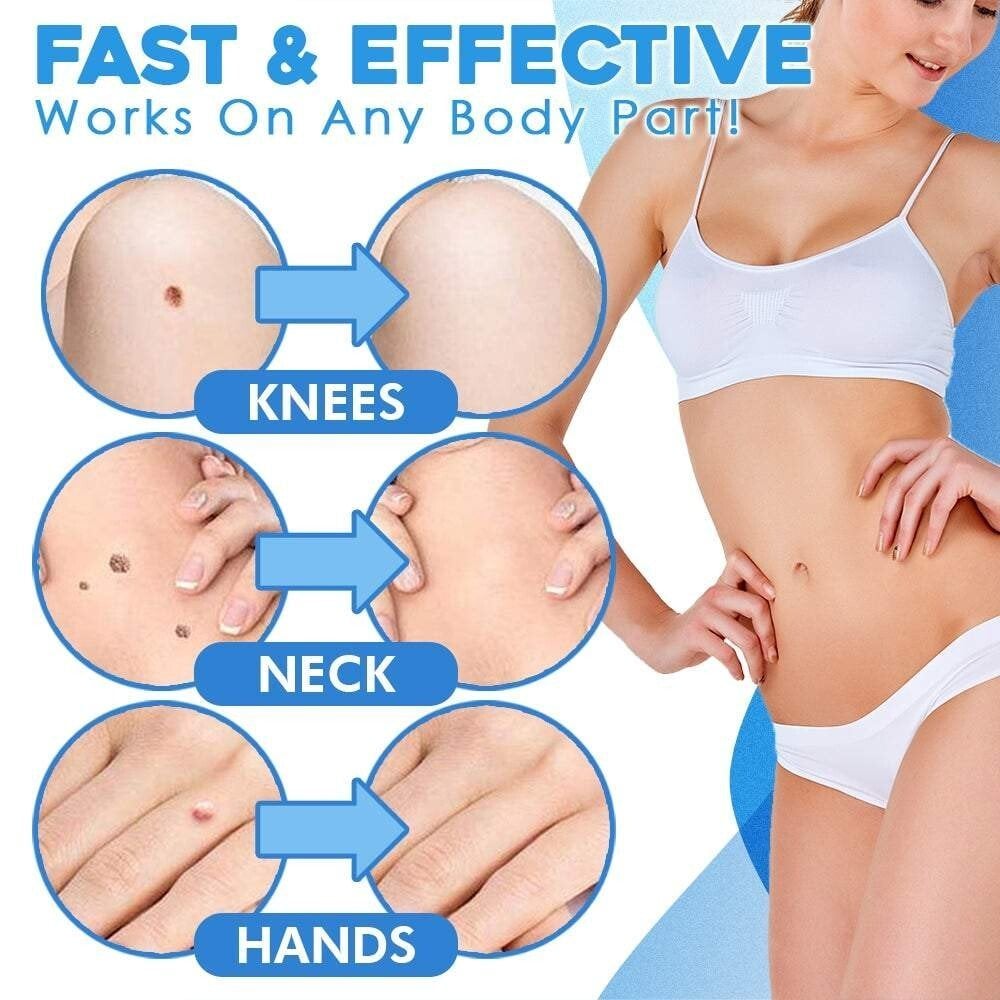 TagGone Kit de Retrait Auto-Tag | Application sans douleur | Pour une peau lisse et uniforme