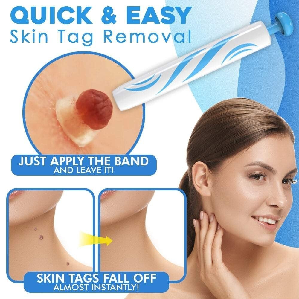 TagGone Kit de Retrait Auto-Tag | Application sans douleur | Pour une peau lisse et uniforme